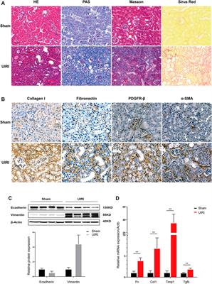 Integrated Analysis of the CircRNA-Based ceRNA Network in Renal Fibrosis Induced by Ischemia Reperfusion Injury